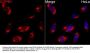 Coatomer Protein Complex Subunit Beta 1 (COPB1) Antibody
