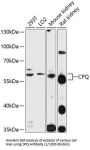 Carboxypeptidase Q (CPQ) Antibody