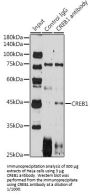 cAMP Responsive Element Binding Protein 1 (CREB1) Antibody