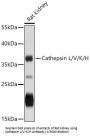 Cathepsin L1 (CTSL) Antibody