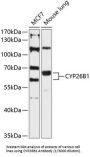 Cytochrome P450 26B1 (CYP26B1) Antibody