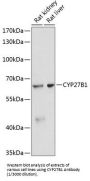 Cytochrome P450 27B1 (CYP27B1) Antibody