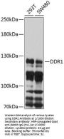 Epithelial Discoidin Domain-Containing Receptor 1 (DDR1) Antibody