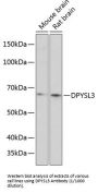 Dihydropyrimidinase Like Protein 3 / CRMP4 (DPYSL3) Antibody