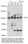 Desmocollin 2 (DSC2) Antibody
