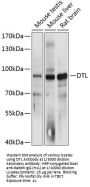 Denticleless Protein Homolog (DTL) Antibody