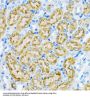 Early Endosome Antigen 1 (EEA1) Antibody
