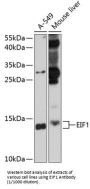 Eukaryotic Translation Initiation Factor 1 (EIF1) Antibody