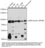 EIF2B5 Antibody