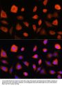 EIF2B5 Antibody