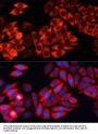 Eukaryotic Translation Initiation Factor 3 Subunit B (EIF3B) Antibody