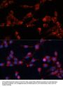 Eukaryotic Translation Initiation Factor 3 Subunit B (EIF3B) Antibody