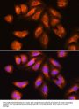 Exosome Component 2 (EXOSC2) Antibody