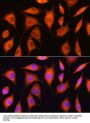 Exosome Component 2 (EXOSC2) Antibody