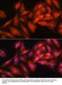 Exosome Component 2 (EXOSC2) Antibody