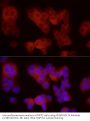 Vascular Endothelial Growth Factor Receptor 3 (FLT4) Antibody