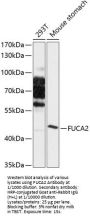 Fucosidase Alpha L2, Plasma (FUCA2) Antibody