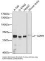 Glomulin (GLMN) Antibody