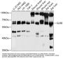 Glycine Receptor Beta (GLRB) Antibody