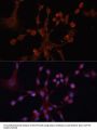 Guanine Nucleotide Binding Protein Subunit Alpha-14 (GNA14) Antibody