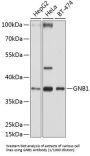 G Protein Beta 1 (GNB1) Antibody