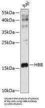 Hemoglobin Beta (HBB) Antibody