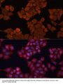 Estradiol 17-Beta-Dehydrogenase 1 (HSD17B1) Antibody