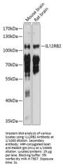 Interleukin 12 Receptor Beta 2 (IL12RB2) Antibody