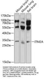 Integral Membrane Protein 2A (ITM2A) Antibody