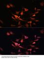 Kelch Like ECH Associated Protein 1 (KEAP1) Antibody