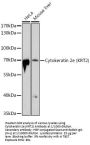 Keratin, Type II Cytoskeletal 2 Epidermal (KRT2) Antibody