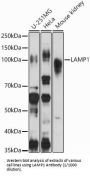 Lysosomal Associated Membrane Protein 1 (LAMP1) Antibody