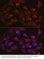 Lysosomal Associated Membrane Protein 1 (LAMP1) Antibody