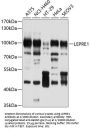 Prolyl 3-Hydroxylase 1 (P3H1) Antibody