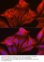 Galectin 1 (LGALS1) Antibody