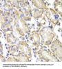 V-Yes-1 Yamaguchi Sarcoma Viral Related Oncogene Homolog (LYN) Antibody
