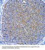 Microtubule-Associated Proteins 1A/1B Light Chain 3A (MAP1LC3A) Antibody