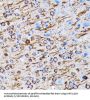 Microtubule-Associated Proteins 1A/1B Light Chain 3A (MAP1LC3A) Antibody