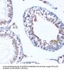 Microtubule-Associated Proteins 1A/1B Light Chain 3A (MAP1LC3A) Antibody