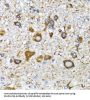 Microtubule-Associated Proteins 1A/1B Light Chain 3A (MAP1LC3A) Antibody