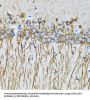 Microtubule-Associated Proteins 1A/1B Light Chain 3A (MAP1LC3A) Antibody