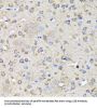 Microtubule-Associated Proteins 1A/1B Light Chain 3B (MAP1LC3B) Antibody