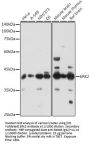 Mitogen-Activated Protein Kinase 1 / ERK2 (MAPK1) Antibody