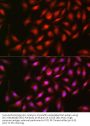 Mitogen-Activated Protein Kinase 1 / ERK2 (MAPK1) Antibody