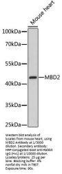 Methyl-CpG Binding Domain Protein 2 (MBD2) Antibody