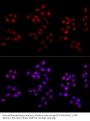 Proliferation Marker Protein Ki-67 (MKI67) Antibody