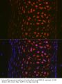 Matrix Metalloproteinase 13 (MMP13) Antibody