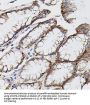 Matrix Metalloproteinase-9 (MMP9) Antibody