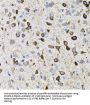 Matrix Metalloproteinase-9 (MMP9) Antibody
