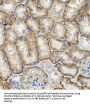 Matrix Metalloproteinase-9 (MMP9) Antibody
